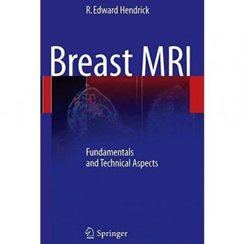 Breast MRI: Fundamentals and Technical Aspects