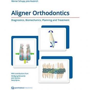 Aligner Orthodontics: Diagnostics, Biomechanics, Planning and Treatment