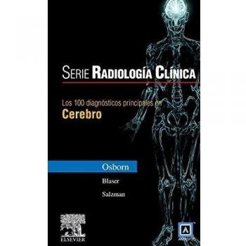 Serie Radiología Clínica: Los 100 diagnósticos principales en cerebro