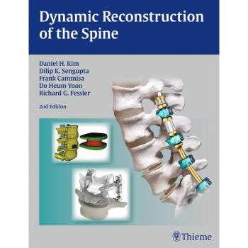 Dynamic Spine Reconstruction Guide
