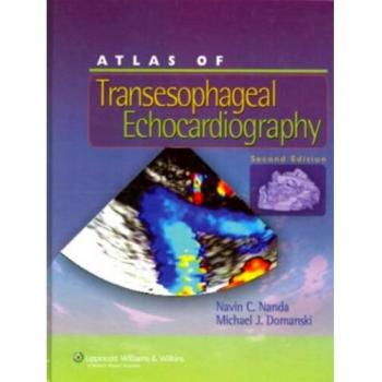 Atlas of Transesophageal Echocardiography