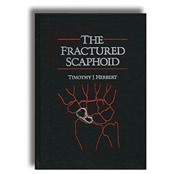 The Fractured Scaphoid