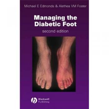 Diabetic Foot Care Management Guide