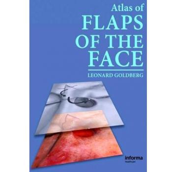 Atlas of Flaps of the Face