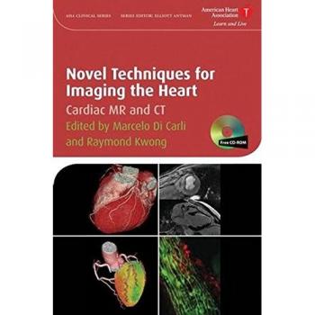 Heart Imaging Techniques: A Comprehensive Guide