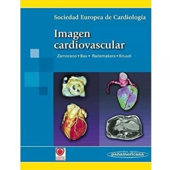 Imagen cardiovascular