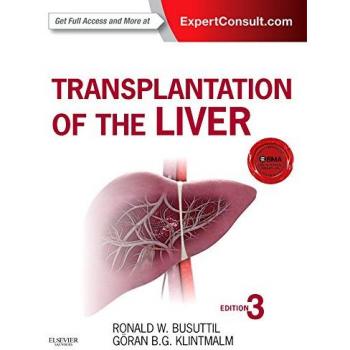 Transplantation of the Liver, 3e