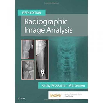 Radiographic Image Analysis, 5e