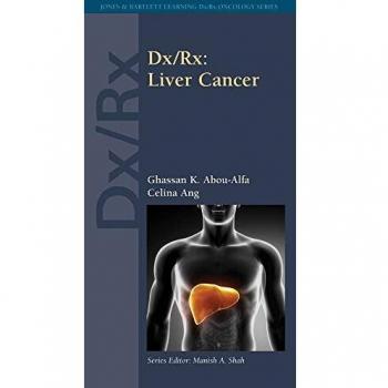 Dx/Rx: Liver Cancer: Liver Cancer