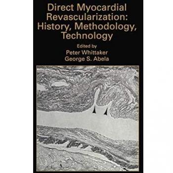 Direct Myocardial Revascularization: Comprehensive Guide to History, Methodology, and Technological Advances in Cardiovascular Medicine