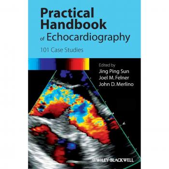 Echocardiography Practical Handbook: 101 Case Studies Edition