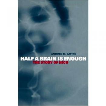 La mitad de un cerebro es suficiente: La historia de Nico (Estudios de Cambridge en Desarrollo Cognitivo y Perceptual, Volumen 5)