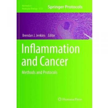 Inflammation and Cancer: Methods and Protocols: 1725