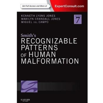 Smith's Recognizable Patterns of Human Malformation: Expert Consult - Online and Print, 7e