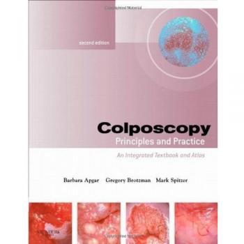 Colposcopy: Principles and Practice, Text with DVD, 2e