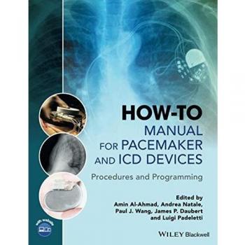 How-to Manual for Pacemaker and ICD Devices: Procedures and Programming