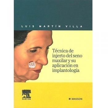Técnica de injerto del seno maxilar y su aplicación en implantología