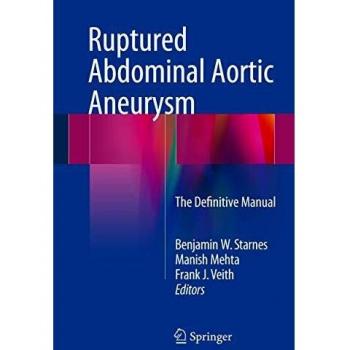 Ruptured Abdominal Aortic Aneurysm: The Definitive Manual