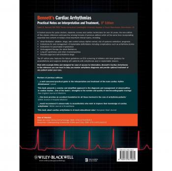 Cardiac Arrhythmias: Practical Interpretation and Treatment Guide