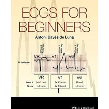 ECGs for Beginners