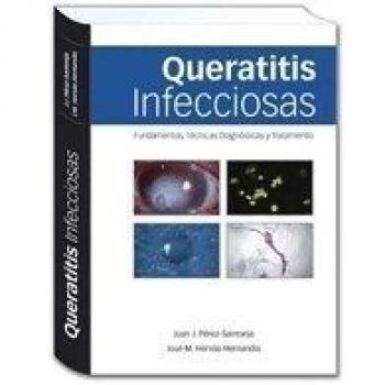 QUERATITIS INFECCIOSAS FUNDAMENTOS TECNICAS DIAGNOSTICAS