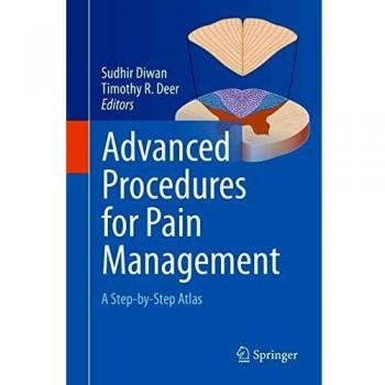 Advanced Procedures for Pain Management: A Step-by-Step Atlas