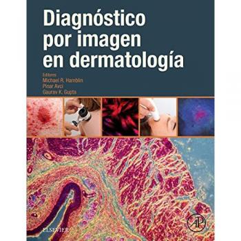 Diagnóstico por imagen en dermatología, 1e